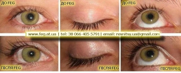 Фото Наращивание ресниц сывороткой FEG Eyelash Enhancer оптом и в розницу напрямую с завода