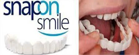 Фото Snap-On Smile – удобные съемные виниры