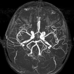 фото МР-венография головного мозга