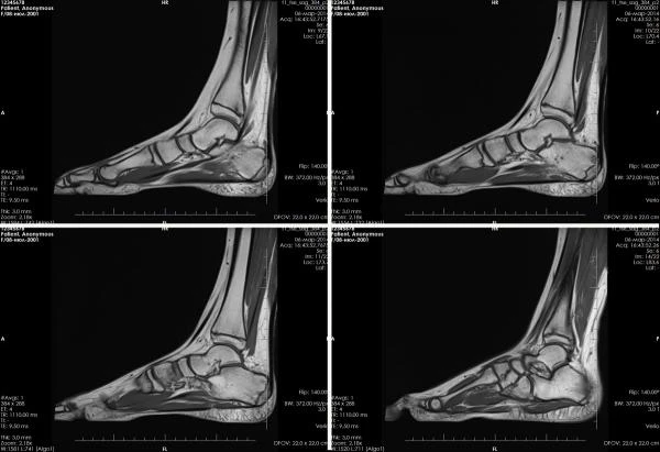 Фото МРТ стопы
