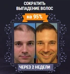 фото От выпадения волос Hair MegaSpray