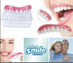 фото Perfect Smile Veneer – простые и удобные съемные виниры