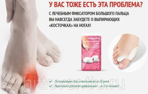 Фото Valgus Pro вылечит косточку на ноге просто и быстро!