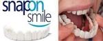 фото Snap-On Smile – удобные съемные виниры